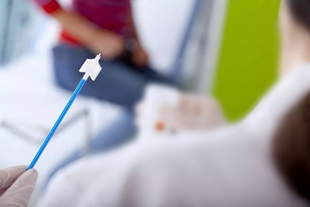 Напредък при скрининг на рак на шийката на матката: Ролята на HPV тестовете за самоколекция