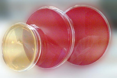 Agar Salmonella Shigella (SS): Основната среда за патогенна изолация