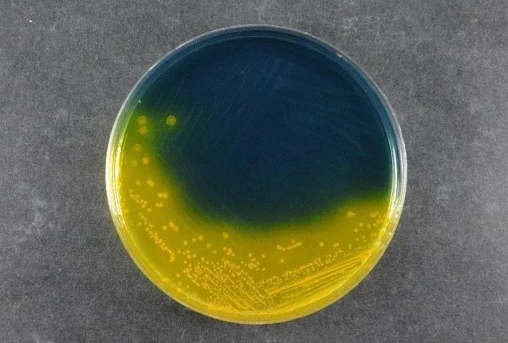 Осигуряване на безопасност на храните: Salmonella Salmonella Shigella Agar (SS) поддържа глобални стандарти за откриване на патогени