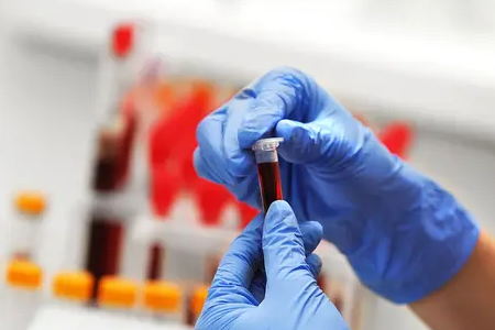 Бързо откриване на малария: Комплектът за двоен антигенен тест на BABIO дава възможност на глобалното здраве