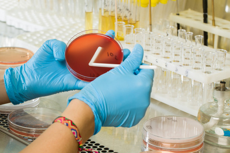 MacConkey Agar Medium на BABIO – първокласна селективна изолация за глобална микробиологична диагностика